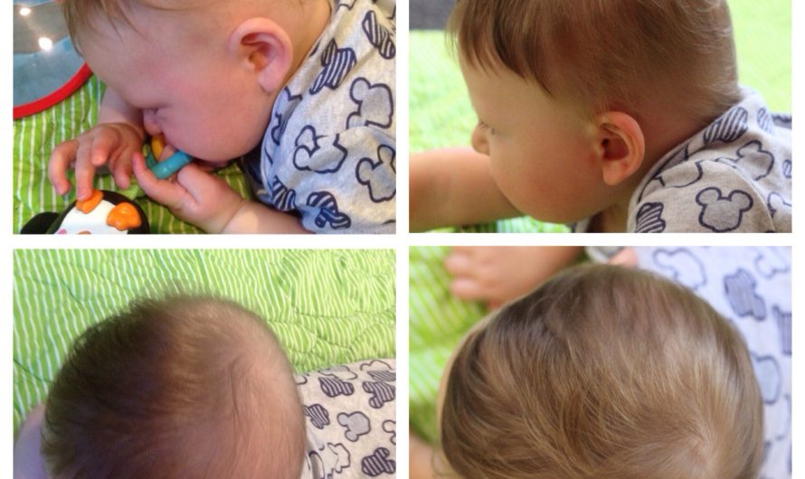 Putting the ‘Play’ in Plagiocephaly (pla•gi•o•ceph•a•ly)