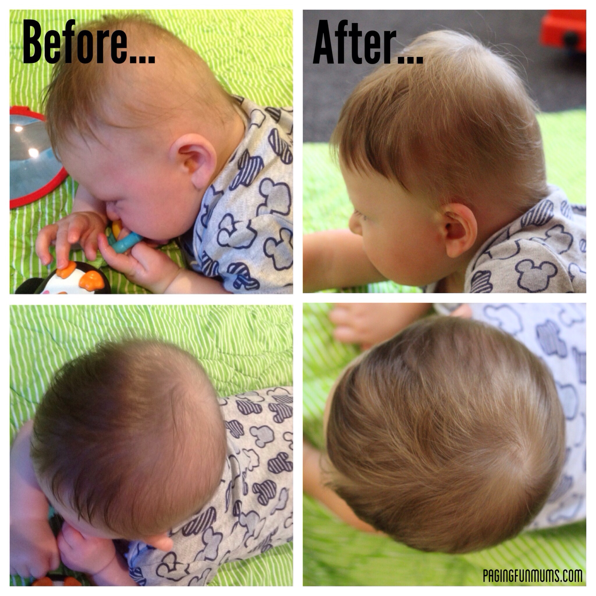 Putting the Play in Plagiocephaly (pla•gi•o•ceph•a•ly) - Paging Fun Mums