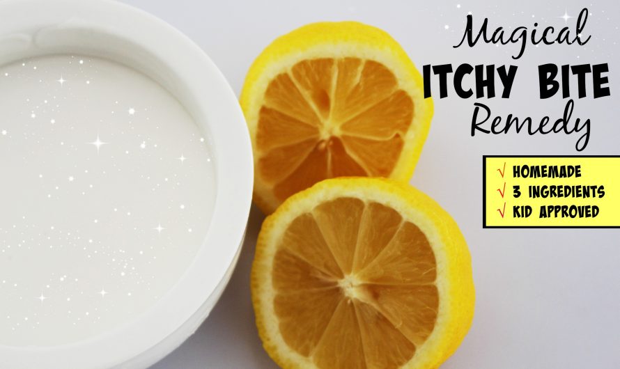 Magical Itchy Bite Remedy – made with only 3 ingredients